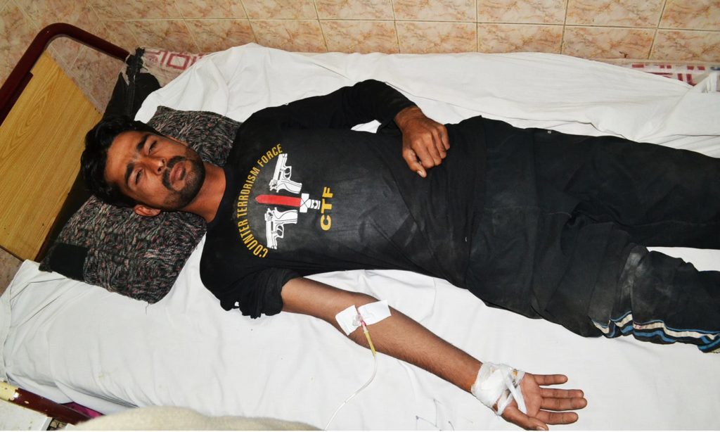 An injured Pakistani commando lies on a bed at a local hospital in Quetta, Pakistan, Monday, Oct. 24, 2016. Gunmen stormed a police training center in the restive southwestern province of Baluchistan Monday, leaving scores of people killed and many wounded, authorities said. (AP Photo/Arshad Butt)