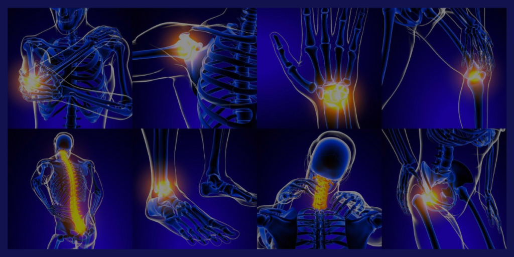  Phantom Limb Pain Relief