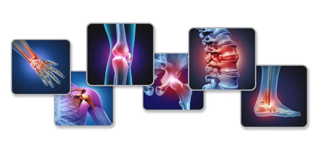 Joint Pain and Inflammation